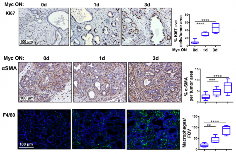 Myc instructs and maintains pancreatic adenocarcinoma phenotype - preLights