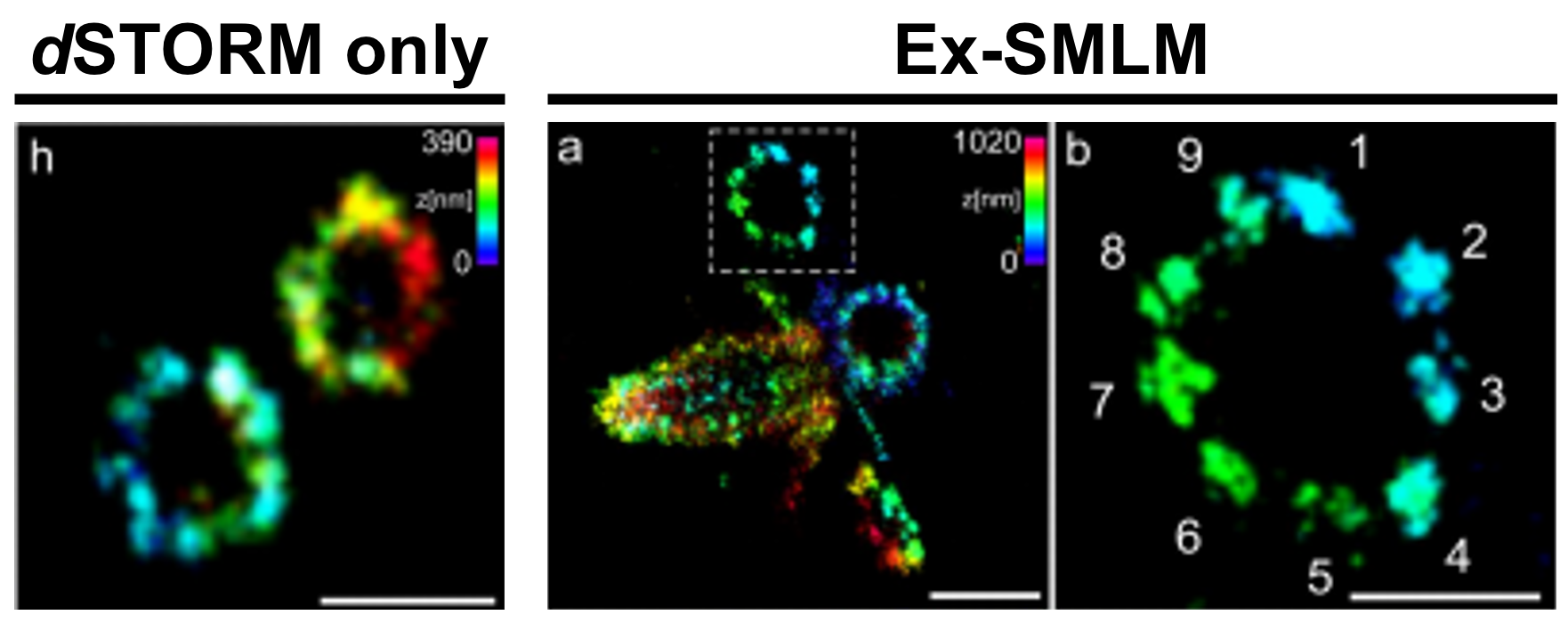 Molecular Resolution Imaging By Post Labeling Expansion Single Molecule Localization Microscopy