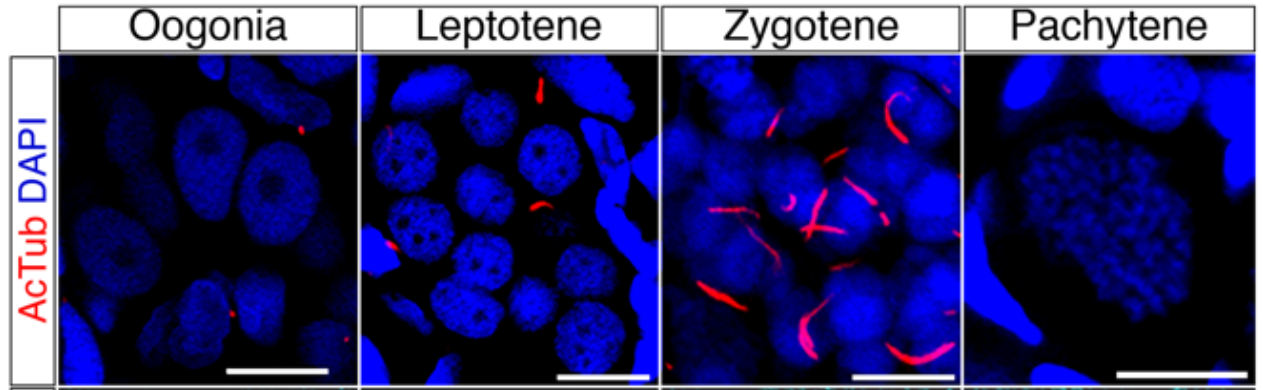 Ciliary control of meiotic chromosomal pairing mechanics and germ cell ...
