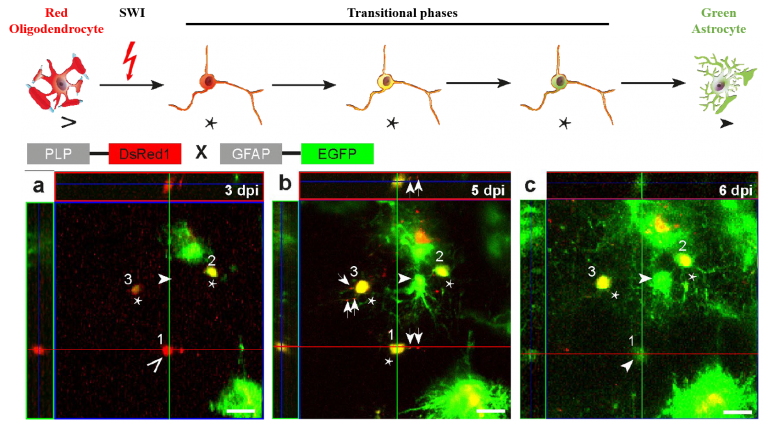 After traumatic brain injury oligodendrocytes regain a plastic ...