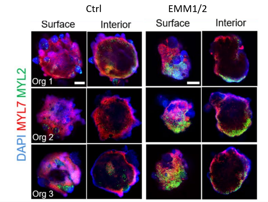 A Patterned Human Heart Tube Organoid Model Generated By Pluripotent ...