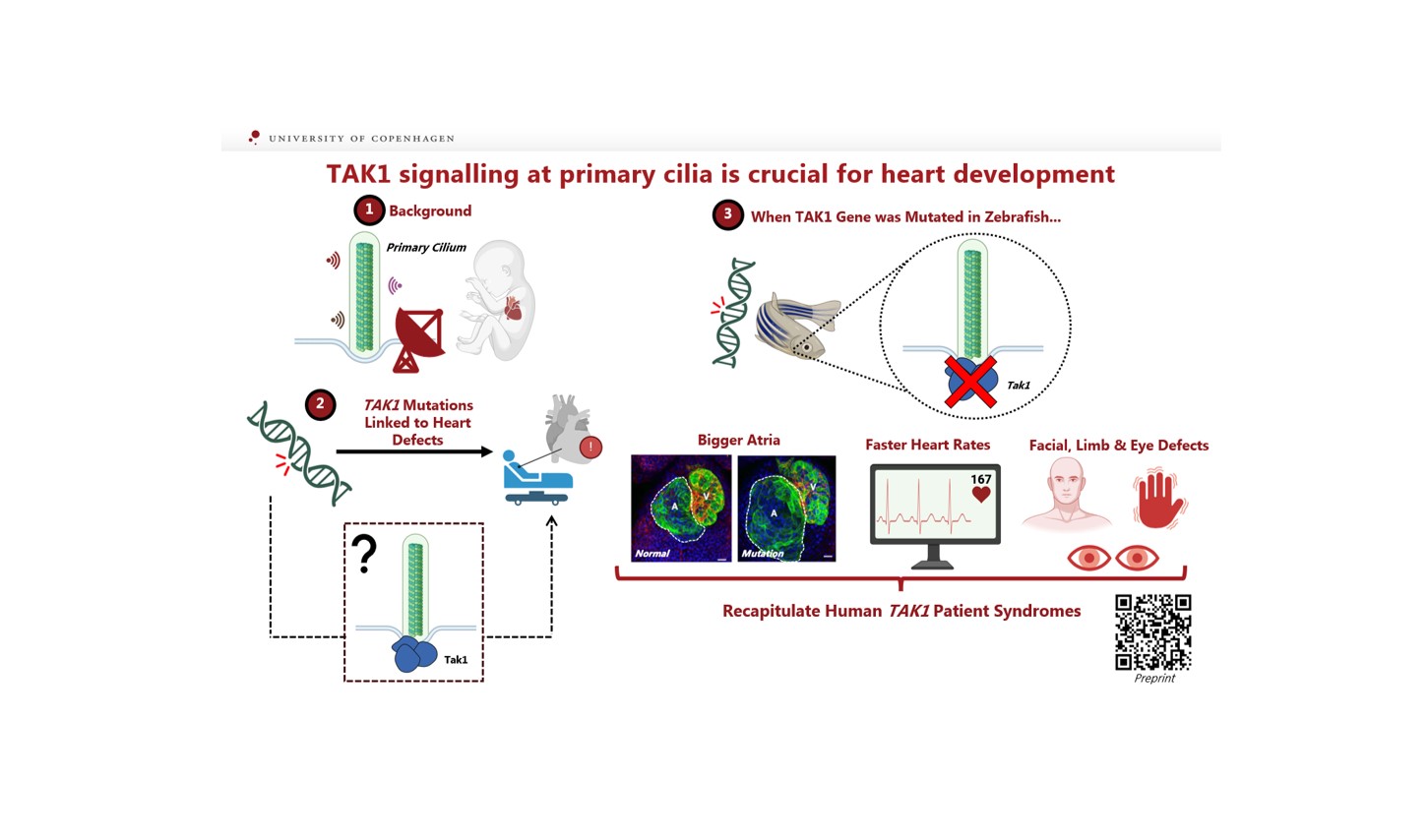 TAK1 operates at the primary cilium in non-canonical TGFB/BMP signaling ...